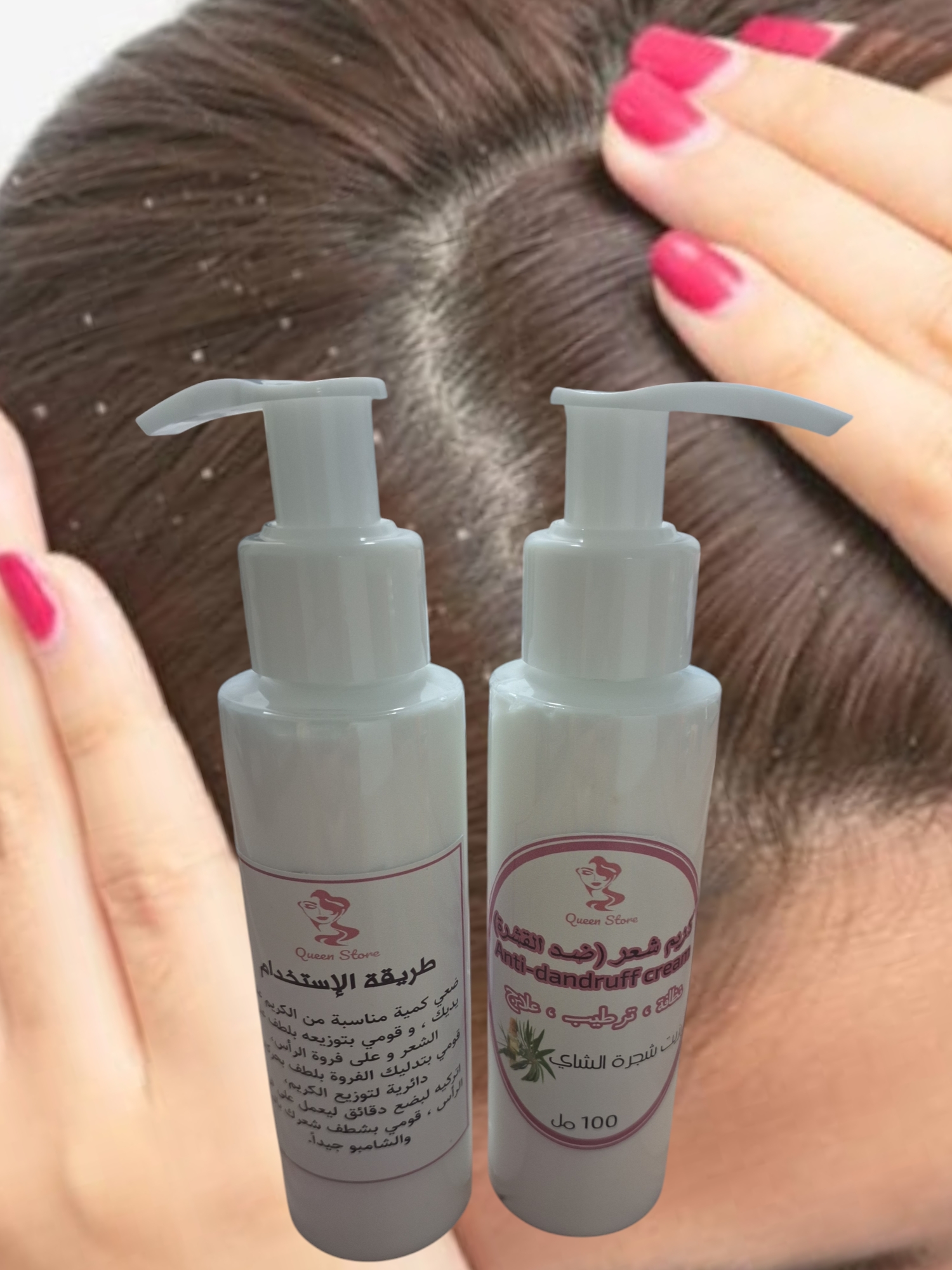 كريم علاج القشرة